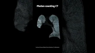 Photon-counting CT