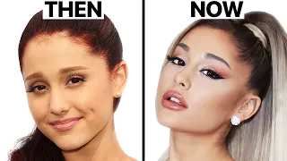 Ariana Grande Plastic Surgery Analysis