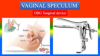 VAGINAL SPECULUM - Definition ,types , parts, uses, Precautions, How to use ?- OBG Surgical Devices