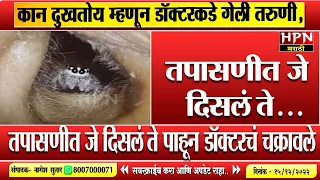 कान दुखतोय म्हणून डॉक्टरकडे गेली तरुणी,तपासणीत जे दिसलं ते... | Viral Video | Hpn Marathi News