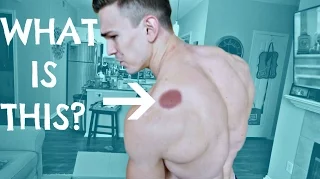 WHAT POPPED UP ON MY BACK? CHEST WORKOUT