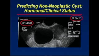 Ovary Patterns, Pearls, and Pitfalls in Adnexal Imaging