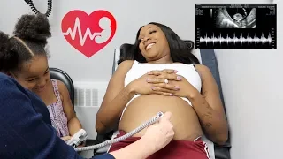 HEARING BABY'S HEARTBEAT FOR FIRST TIME!! (DOCTORS APPOINTMENT)