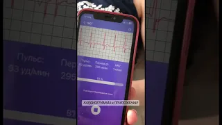 КАК СДЕЛАТЬ ЭКГ ДОМА удобно под контролем в телефоне #лечениеинфарктамиокарда #нейросеть #дом #4k