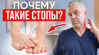 КАК УБРАТЬ ЗАВАЛ СТОПЫ ВО ВНУТРЬ? Самый эффективный способ устранения проблемы