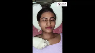 Get Mole Removal Result by Radio Frequency Ablation |Dr. Shweta Nanglia, Dermatologist