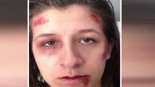 Father claims Coral Springs High failed to act after daughter beaten up