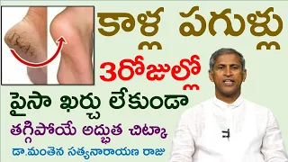 కాళ్ళ పగుళ్ళు చిటికెలో తగ్గాలంటే|Kaalla pagullu|How to Get Rid of Dry Cracked Feet FAST| GOOD HEALTH