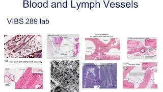Medical School Histology Basics - Blood and lymph vessels