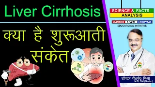 Liver Cirrhosis क्या है शुरुआती संकेत ? || CIRRHOSIS OF LIVER