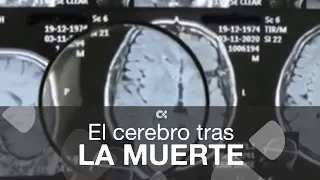 El cerebro tras la muerte