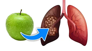 Ob Raucher oder Ex-Raucher: Diese 5 Lebensmittel entgiften deine Lunge!