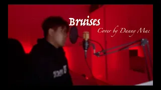 Bruises - Lewis Capaldi (Cover By Danny Mac)