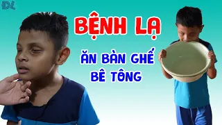 7 năm ăn bàn ghế, xi măng, đất cát... không ăn cơm. Vì sao ? - ĐỘC LẠ BÌNH DƯƠNG