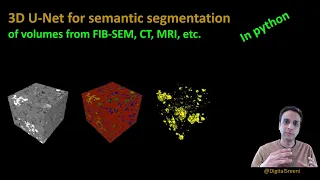 215 - 3D U-Net for semantic segmentation