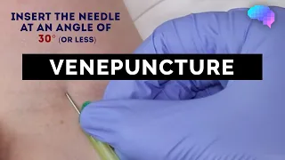 Venepuncture - How to take a blood sample - OSCE Guide | UKMLA | CPSA