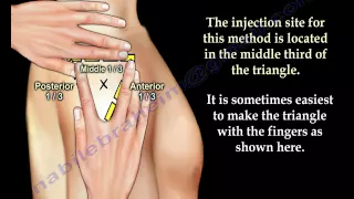 Deltoid Intramuscular injection - Everything You Need To Know - Dr. Nabil Ebraheim