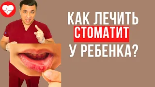 Как лечить стоматит у детей?Смотри описание к видео.