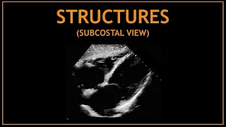 Cardiac STRUCTURES! Subcostal views, Echocardiography.