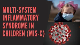 Multisystem Inflammatory Syndrome in Children (MIS-C) Review