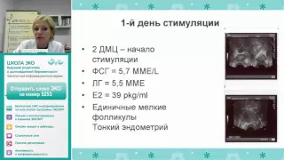 Основные этапы ЭКО. Стимуляция суперовуляции. Вебинар Е.А. Калининой