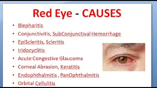 Ophthalmology 167 Acute Red Eye Differential Diagnosis causes Conjunctivitis Uveitis Glaucoma