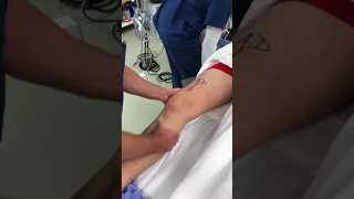 Knee Exam Under Anaesthesia (EUA) - ACL rupture