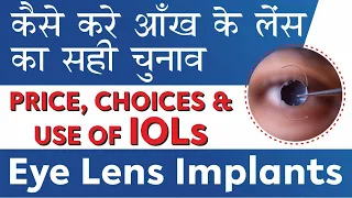 Price, Choice & Benefits of IOL Lenses - Lens for Cataract Surgery कैसे करे आँख के लेंस का सही चुनाव