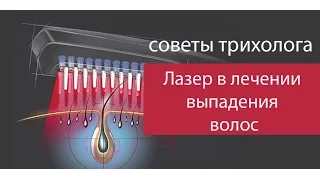 Лазер в лечении выпадения волос