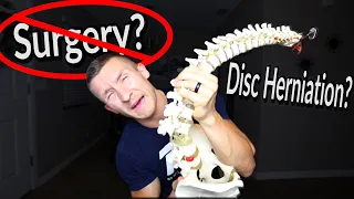 Disc Herniation Recovery WITHOUT Surgery?! | 97% Success Rate!