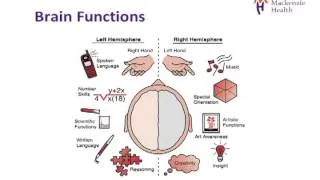 Stroke Education - Causes and Effects