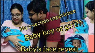 My c-section experience.Baby boy or girl🤔Baby's face reveal❤️❤️Hospital honest review.C-section cost