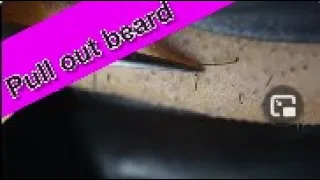 Extractions Ingrown Hair l Tweezers Beard l Full HD 2020/11/22