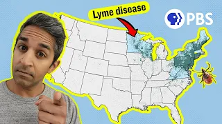 Lyme Disease Cases Are Surging. Who Is Most At Risk?
