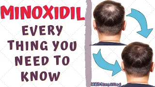 DOES MINOXIDIL REALLY TREAT HAIRFALL??