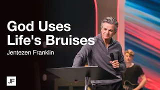 God Uses Life's Bruises | Jentezen Franklin