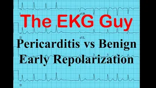 EKG/ECG - Pericarditis vs Benign Early Repolarization | The EKG Guy - www.ekg.md