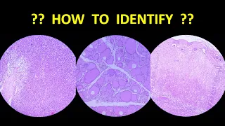 Identification of Systemic Histology Slides - Part I
