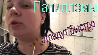 💥ПАПИЛЛОМЫ💥 как я удаляла народными средствами