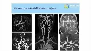 МР-визуализации в дифференциальной диагностике