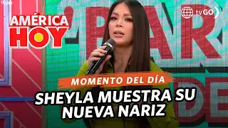 América Hoy: Sheyla Rojas talks about her nose operation (TODAY)