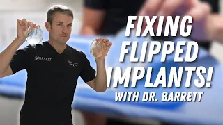 Fixing Flipped Implants With Amazing Results! | Barrett