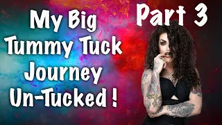 My Tummy Tuck Journey PART 3