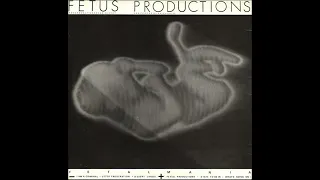 Fetus Productions - Fetalmania and Fetus Product (Full Album / Personal Mix)