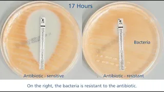 What happens if you misuse antibiotics?