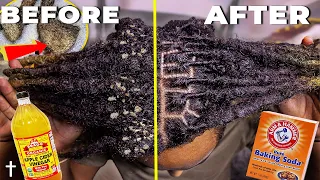 HOW TO ACV RINSE YOUR DREADLOCKS | Step By Step Tutorial