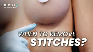 When to Say Goodbye to Stitches After a Breast Surgery? | BTM5 EP.6