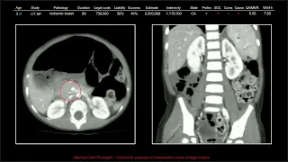 137 Years of Medical Malpractice Part 5 | Free Radiology CME