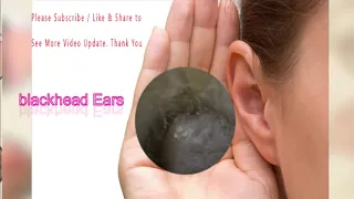 blackhead Ears / 完全にブロックされた耳垢の除去 / ear wax removal 038