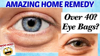 Over 40? Get Rid Of EYE BAGS & PUFFY UNDER EYES